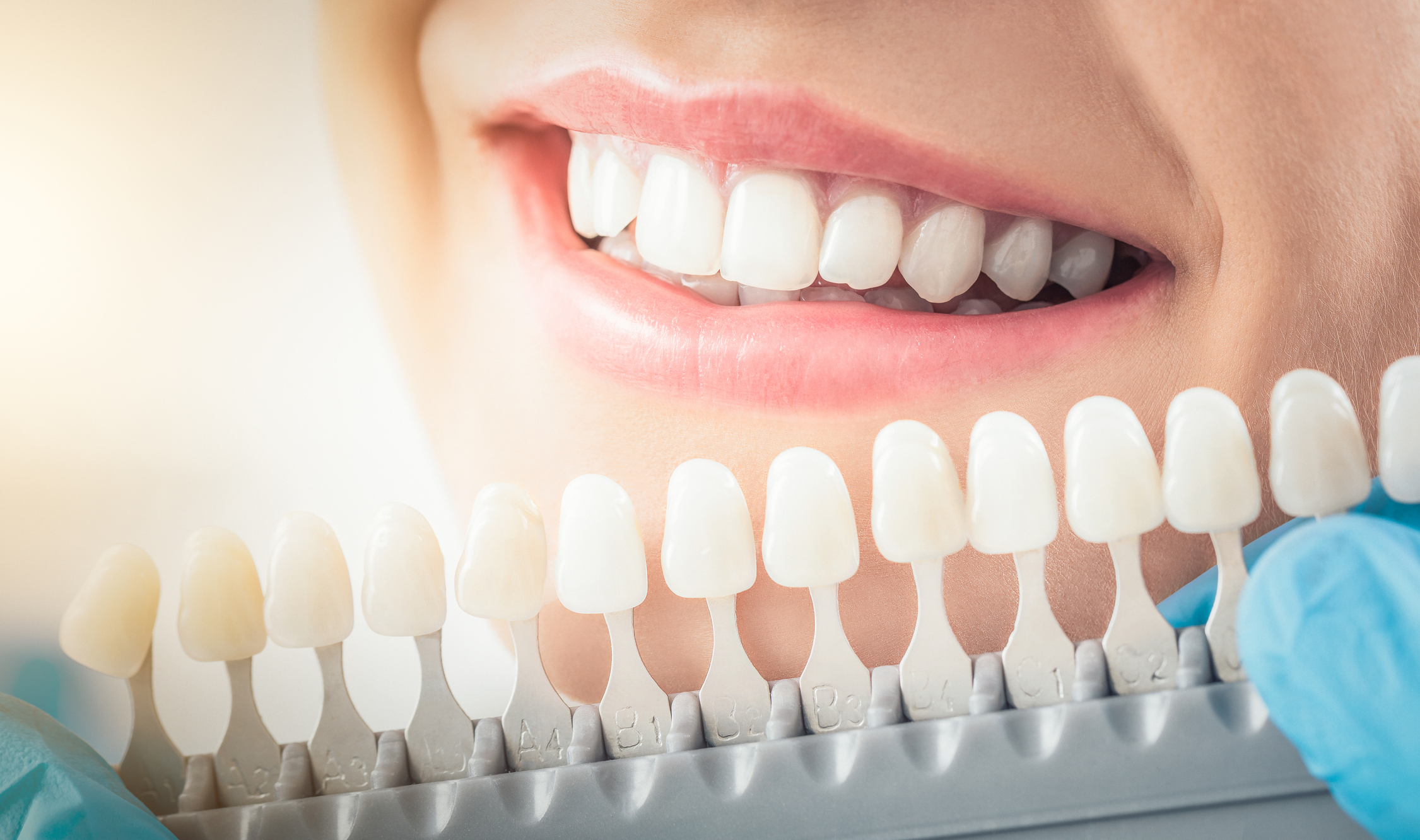 Professional teeth whitening treatment
